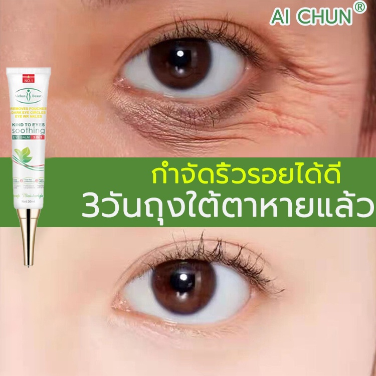 Aichun ครีมลดถุงใต้ตา 30ml ครีมทาขอบตาดำลดริ้วรอยรอบดวงตา