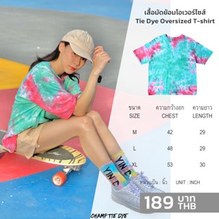 เสื้อยืดมัดย้อม โอเวอร์ไซส์ คอกลม ไซส์ใหญ่พิเศษ คนอ้วน เสื้อเด็ก ได้ทั้งชายหญิง Tie Dye Oversized  kids T-shirt unisex