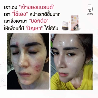 โปรโมชั่น 9 ปี สบู่เล็ก 50 กรัม