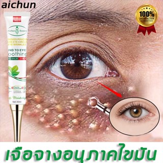 Aichun เม็ดไขมัน 30ml ลบคล้ำบวมใต้ตา กระชับรอยตีนกา ลดเม็ดไขมัน ฟื้นฟูผิวตา ครีมทารอบดวงตา เซรั่มอายครีม อายครีม