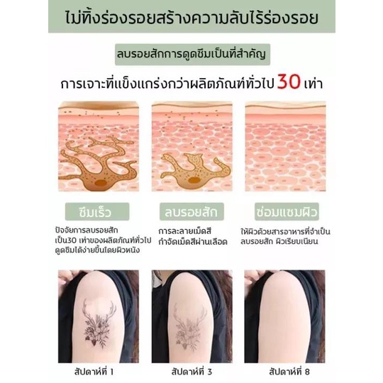ไม่ต้องเลเซอร์! น้ำยาลบรอยสัก13g ลบรอยสักไม่ต้องเลเซอร์ สามารถใช้ได้กับส่วนต่างๆของร่างกาย(ครีมลบลอยสัก ครีมปิดรอยสัก)