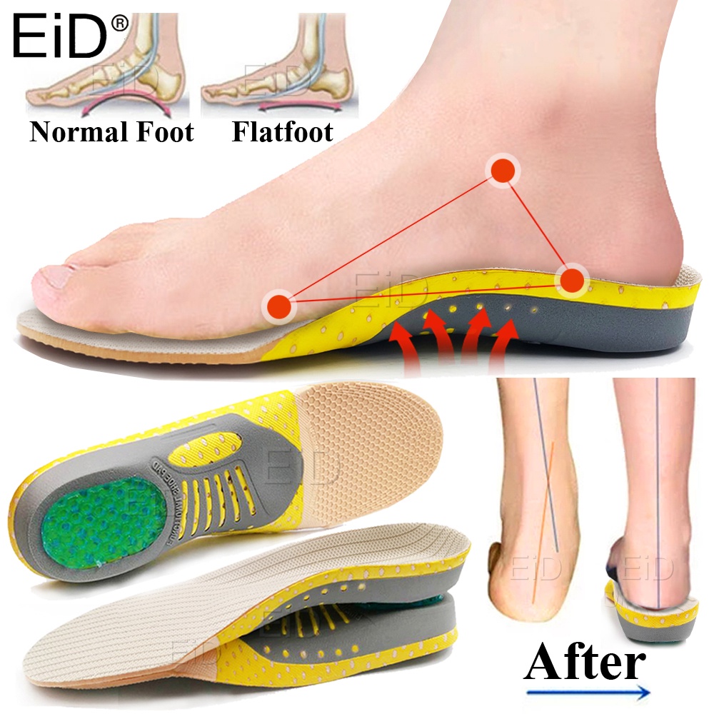 ที่ดีที่สุด PVC Orthopedic เจลรองเท้า Sole Insoles สําหรับเท้าเท้าแบน Arch สนับสนุน Pas X/O ประเภทขาแก้ไขกีฬารองเท้าใส่ Unisex