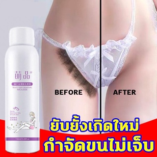 MENGPIN มูสกำจัดขน 150ml กำจัดขนน้องสาว กำจัดขนอย่างอ่อนโยน กำจัดขนรักแร้ hair removal สเปรย์กำจัดขนถาวร ครีมกำจัดขน