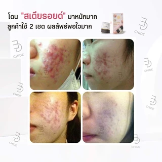 โปรโมชั่น 9 ปี สบู่เล็ก 50 กรัม