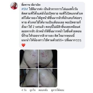 [ของแท้] SM SKIN ME ครีมโสมไข่มุก ลดฝ้า หน้าใส ไร้สิว ไม่มีสารอันตราย 10 กรัม ครีมคุณวี่