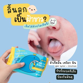 Oh Whale Baby ที่เช็ดฝ้าขาวบนลิ้นเด็กทารก ผ้าเช็ดฟัน เหงือก Xylitol &amp; Citrofresh ใช้แทนผ้าก๊อซ เช็ดเต้านมแม่