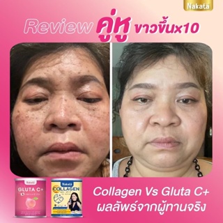 โปร3แถม3ส่งฟรีเห็นผลจริง ขาวไว กลูต้า คอลลาเจน เร่งขาว ไม่ต้องฉีดผิว ฟื้นฟูผิว ขาว ใส อ่อนวัย ฝ้ากระ ดำแดด ผิวคล้ำเสีย