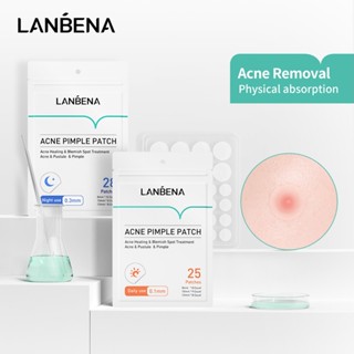 LANBENA แผ่นแปะสิว รักษาสิว 25 ชิ้น / สูตรกลางคืน 28 ชิ้น ดูแลผิวหน้าสิว