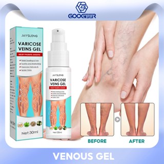 Jaysuing Varicose Veins Spray เจลบรรเทาอาการปวดขา ปวดน่อง เส้นเลือดขอด กําจัดเส้นเลือดขอด สําหรับซ่อมแซมเส้นเลือดขอด ขา เจล เส้นเลือดขอด เจลซ่อมแซมเส้นเลือดขอด สําหรับผู้ป่วยหลังคลอด คนอ้วน 30 มล.