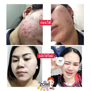 ⦂🐰โซมิ เฟเชียล เคลียร์ ครีม Zomi Cream