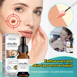 [ซื้อ 1 ฟรี 1] EELHOE เซรั่มกําจัดจุดด่างดํา และไฝ เอสเซนส์บํารุงผิว