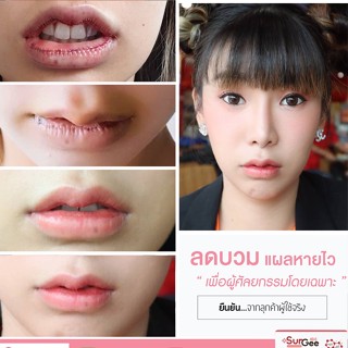 Surgee เซอร์จี้ อาหารเสริมลดบวมช้ำเร่งสมานแผล 2 กล่อง