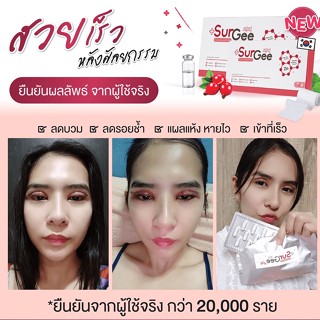 Surgee เซอร์จี้ ยาลดบวม ลดรอยช้ำเร่งสมานแผล 3 กล่อง