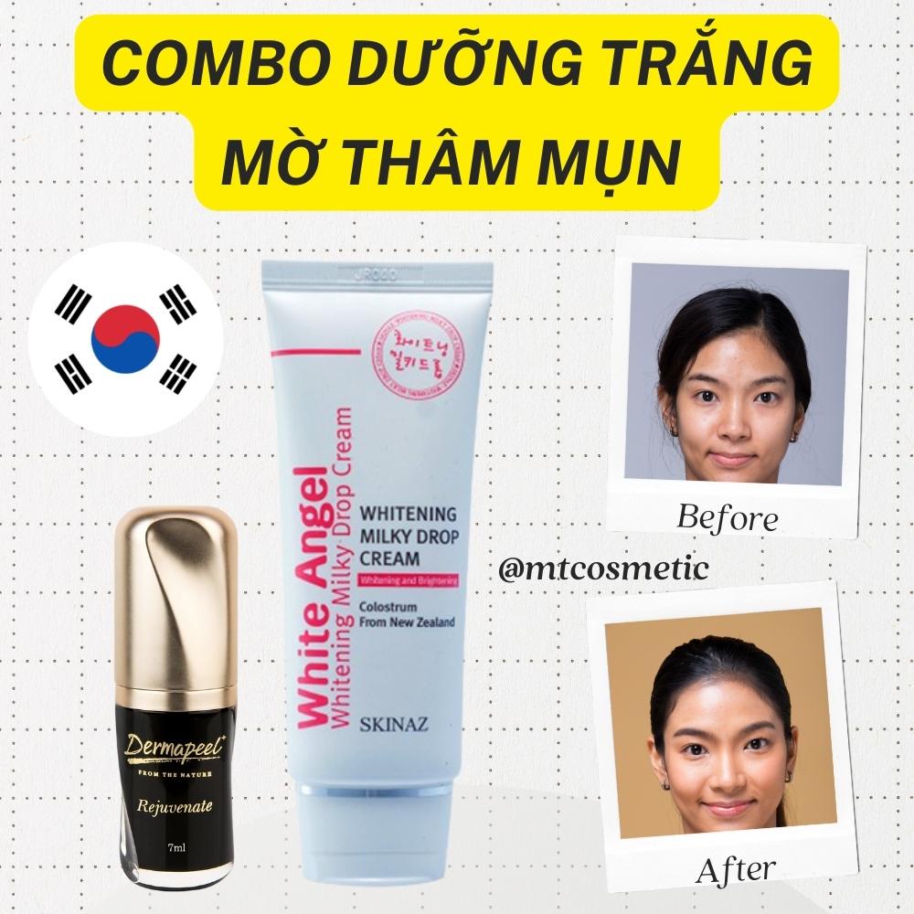 Combo Korean acne dark spots - Dermapeel cod acne Serum 7ml - White Angel Skinaz Cream 70g