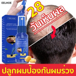 ราคาถูกสุด EELHOE สเปรย์ เซรั่มปลูกผม ผมขึ้นเร็ว สเปรย์ปลูกผม30ml เซรั่มปลูกผม ป้องกันผมร่วง น้ำยาปลูกผม 99 บาท เท่านั้น