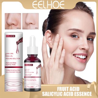 Eelhoe AHA30%+BHA เอสเซ้นต์กรดซาลิไซลิก 2% ขัดผิวหน้า กําจัดสิวหัวดํา กระชับรูขุมขน กรดซาลิซิลิก จุดด่างดํา ผิวหดตัว ต่อต้านริ้วรอยก่อนวัย เซรั่มบํารุงผิวหน้า 30 มล.