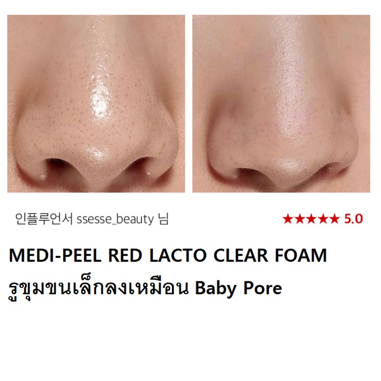 MEDIPEEL Red Lacto Collagen Cleansing Balm to Oil/Cleansing Oil/Clear 2.0 - รูปที่ 5