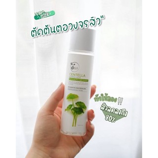 ☘️คลีนซิ่งสูตรน้ำ☘️ เช็ดเครื่องสำอาง สำหรับคนเป็นสิว Eira Cleansing Water 150 ml. พี่กุ้งกดสิว มาดามกิ๊กกี้