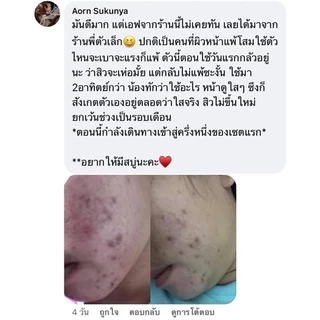 [ของแท้] SM SKIN ME ครีมโสมไข่มุก ลดฝ้า หน้าใส ไร้สิว ไม่มีสารอันตราย 10 กรัม ครีมคุณวี่