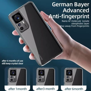 เคส for Xiaomi 17T Pro 15T Pro 17 ultra แม่เหล็ก case