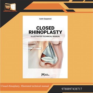 Closed rhinoplasty. Illustrated technical manual