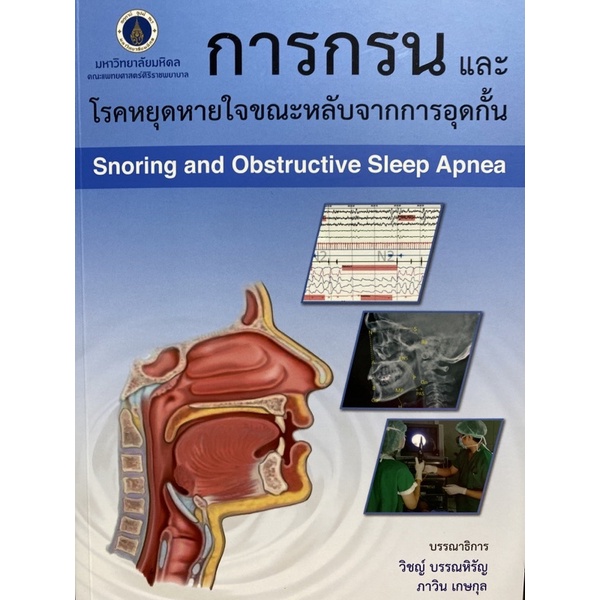 9786164433281 การกรนและโรคหยุดหายใจขณะหลับจากการอุดกั้น (SNORING AND OBSTRUCTIVE SLEEP APNEA)