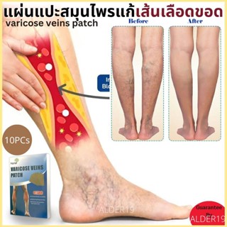 เส้นเลือดขอด varicose veins patch แผ่นแปะ สมุนไพร แผ่นแปะสมุนไพรแก้เส้นเลือดขอด 10 แผ่น