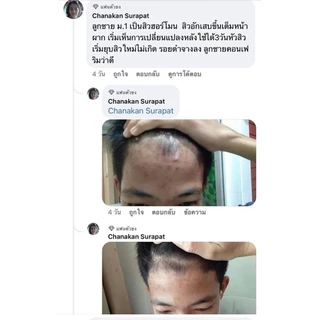 [ของแท้] SM SKIN ME ครีมโสมไข่มุก ลดฝ้า หน้าใส ไร้สิว ไม่มีสารอันตราย 10 กรัม ครีมคุณวี่