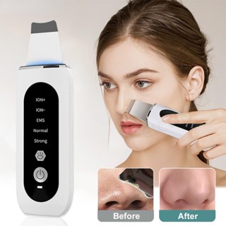 Ultrasonic Skin Scrubber 5 in 1 เครื่องทำความสะอาดรูขุมขนแบบอัลตราโซนิก สิวหัวดำ