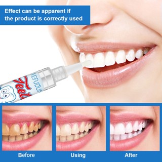 ปากกาฟอกฟันขาว ปากกาฟันขาว Teeth Whitener Pen ปากกาฟอกสีฟัน แผ่นแปะฟันขาว แผ่นฟอกฟันขาว SC9147