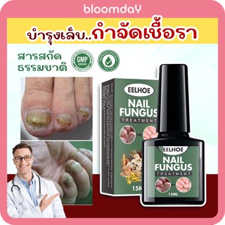 เชื้อราเล็บ น้ํายากันเชื้อราเล็บ Eelhoe Nail fungus  ยาทา รักษาเชื้อราเล็บ ส่วนผสมธรรมชาติ ขนาด 15ML 1 ขวด