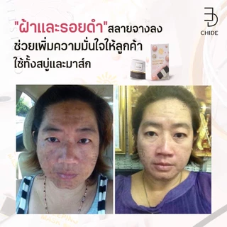 โปรโมชั่น 9 ปี สบู่เล็ก 50 กรัม