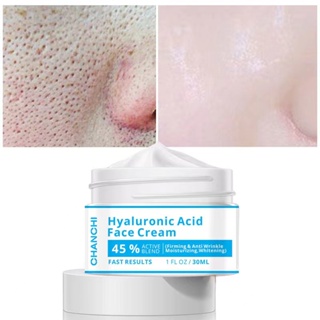 CHANCHI ครีมทาหน้า Hyaluronic Acid 30ml