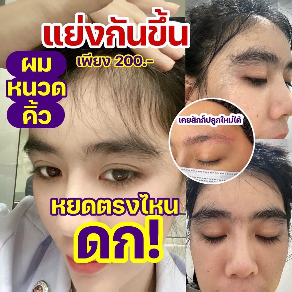 เซรั่มปลูกคิ้ว ปลูกผม ปลูกหนวด เวรี่คิ้วท์ VERY CUTE SERUM ปลูกผมร่วง ผมบาง คิ้วดกดำ เร่งยาว เร่งดก
