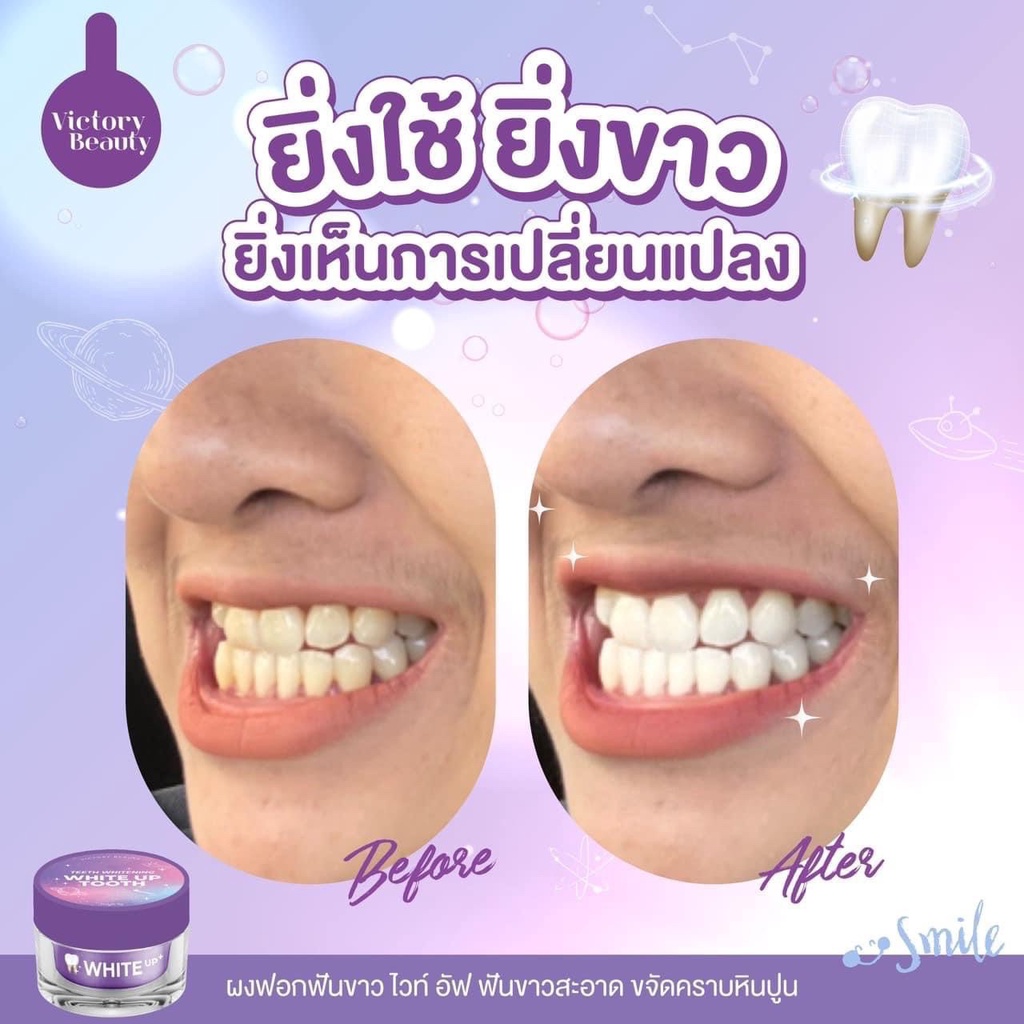 [พร้อมส่ง+ของเเท้] ผงฟอกฟันขาวสูตรอเมริกา ฟันเหลือง หินปูนเยอะ เห็นผลตั้งแต่ครั้งแรก ลดกลิ่นคราบเหลือง