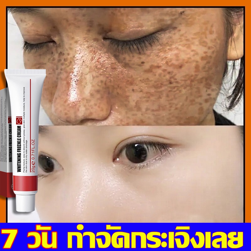 ครีมไวท์เทนนิ่ง ! ครีมทาฝ้าหนาๆ ครีมทาฝ้า ฝ้า กระ จุดด่างดำ สีผิวกระจ่างใสwhitening crea