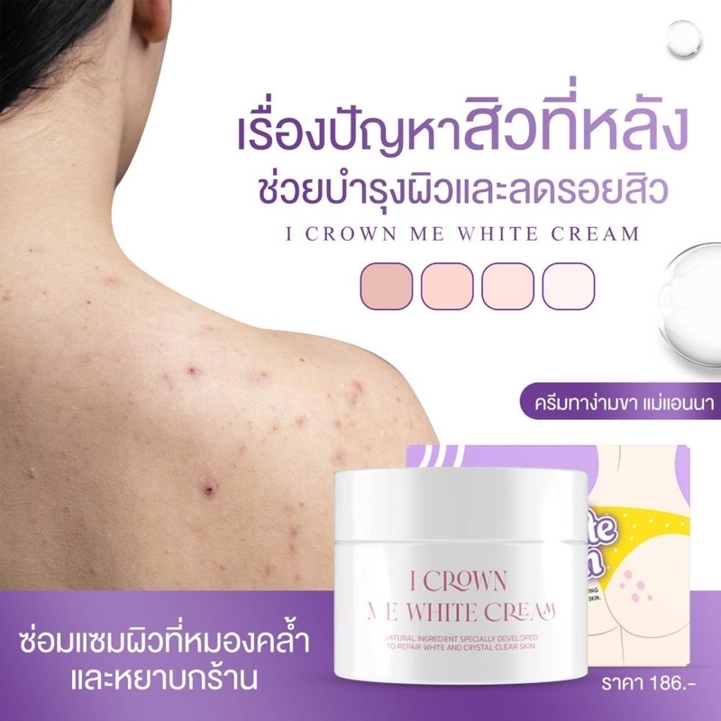 🫶🏻 Me White Cream ครีมทาง่ามขาแอนนา 🫶🏻 [ครีมพร้อมส่ง+ของแท้] ครีมทาง่ามขาแอนนา I Crown Me White Crea