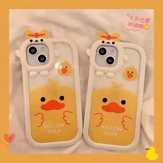 KIDDYพร้อมส่งเคสกล้องลูกเจี๊ยบคัพเค้กสําหรับรุ่น 7p/8p.11.12/12pro.12pro max.13/14.13pro.13pro max.14max.14pro max#3009