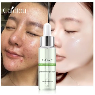 Caidiou whitening drone acne serum เซรั่มสำหรับคนเป็นสิวพร้อมลดรอย 15ml