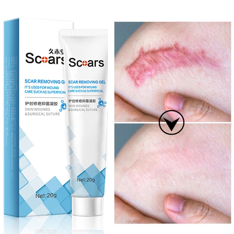 Herbal Scar Removal Cream Gel Repairing Pock Mark Burn Surgical Scar