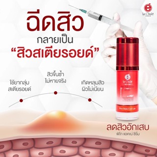 lachule Serum เซรั่ม แต้มสิว สิวยุบหาย ข้ามคืน