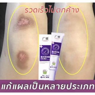 【ผลลัพธ์ที่รวดเร็ว】ครีมลบแผลเป็น 20g ครีมลดรอยแผลเป็นลดแผลไฟไหม้แผลน้ำร้อนลวกแผลผ่าตัดเป็นต้นแผลเป็นหลายประเภทยาลบลอยแผล