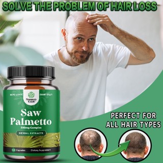 Natures Craft - อาหารเสริมปลูกผม Saw Palmetto สำหรับผู้ชายและผู้หญิง - 60/120 แคปซูล