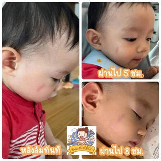 Lynn Organic บิ๊กบาล์ม (15 กรัม) แก๊งค์เบิ้ลๆ 2 แท่ง