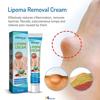 South Moon Lipoma Care Cream Lipolysis Fat Lump บรรเทาพลาสเตอร์ผิวบวมครีม MOLISA