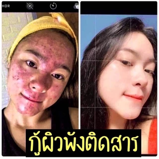 (ของแท้)เซรั่มวิ้งไวท์ สูตรซากุระ WinkWhite