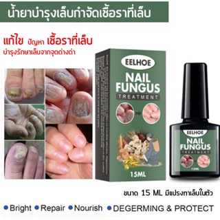 น้ำยาบำรุงเล็บกำจัดเชื้อราที่เล็บ ขนาด 15 ML พร้อมแปรงทาเล็บในตัว