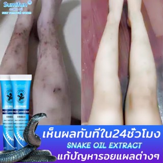 ครีมลบแผลเป็น 20g ครีมลดรอยแผลเป็นลดแผลไฟไหม้แผลน้ำร้อนลวกแผลผ่าตัดเป็นต้นแผลเป็นหลายประเภทยาลบลอยแผลเป็นครีมลดแผลเป็น ค