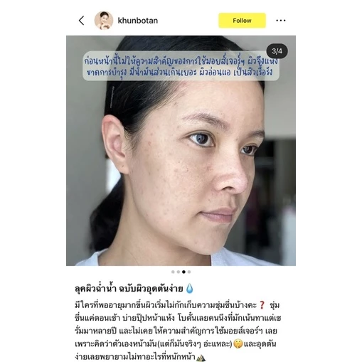 ครีมเซนกะ senka deep moist gel cream สกินแคร์ สำหรับคนหน้าแห้งขาดความชุ่มชื้น เซนกะ senka deep moist gel cream 50g thumbnail 6