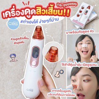 CBG Blackhead Remover เครื่องดูดสิวเสี้ยนอเนกประสงค์